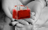 رشد ۱۰ درصدی ذخیره خون بند ناف در خراسان جنوبی