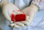 اهمیت ذخیره‌سازی خون بندناف