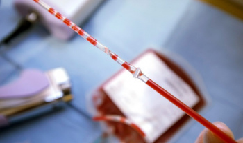 انعقاد ۹۰ قرارداد ذخیره خون بند ناف در خراسان جنوبی