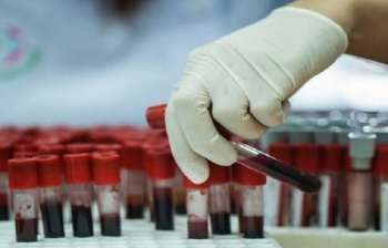 انعقاد ۷۰۰ قرارداد ذخیره خون بند ناف در خراسان جنوبی
