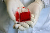 ذخیره خون بند ناف هنگام تولد، بیمه‌ای برای آینده